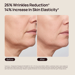 Before-and-after facial close-up; “26% Wrinkles Reduction*” and “14% Increase In Skin Elasticity*,” labeled Before and After.