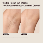 Before-and-after underarm comparison with text: “Visible Result In 4 Weeks,” “18% Reported Reduction Hair Growth,” and “Before” and “After” labels.