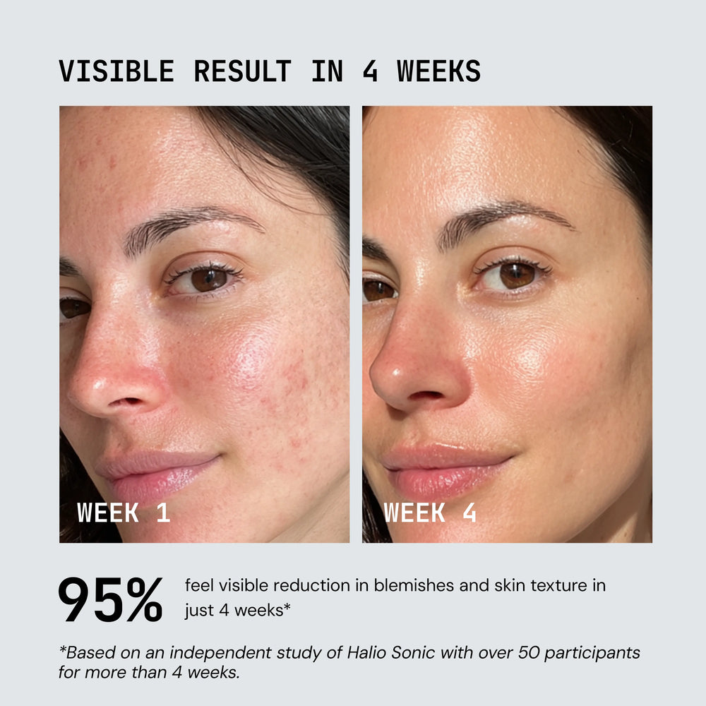 Before and after comparison of a woman's face with text about visible results in 4 weeks.