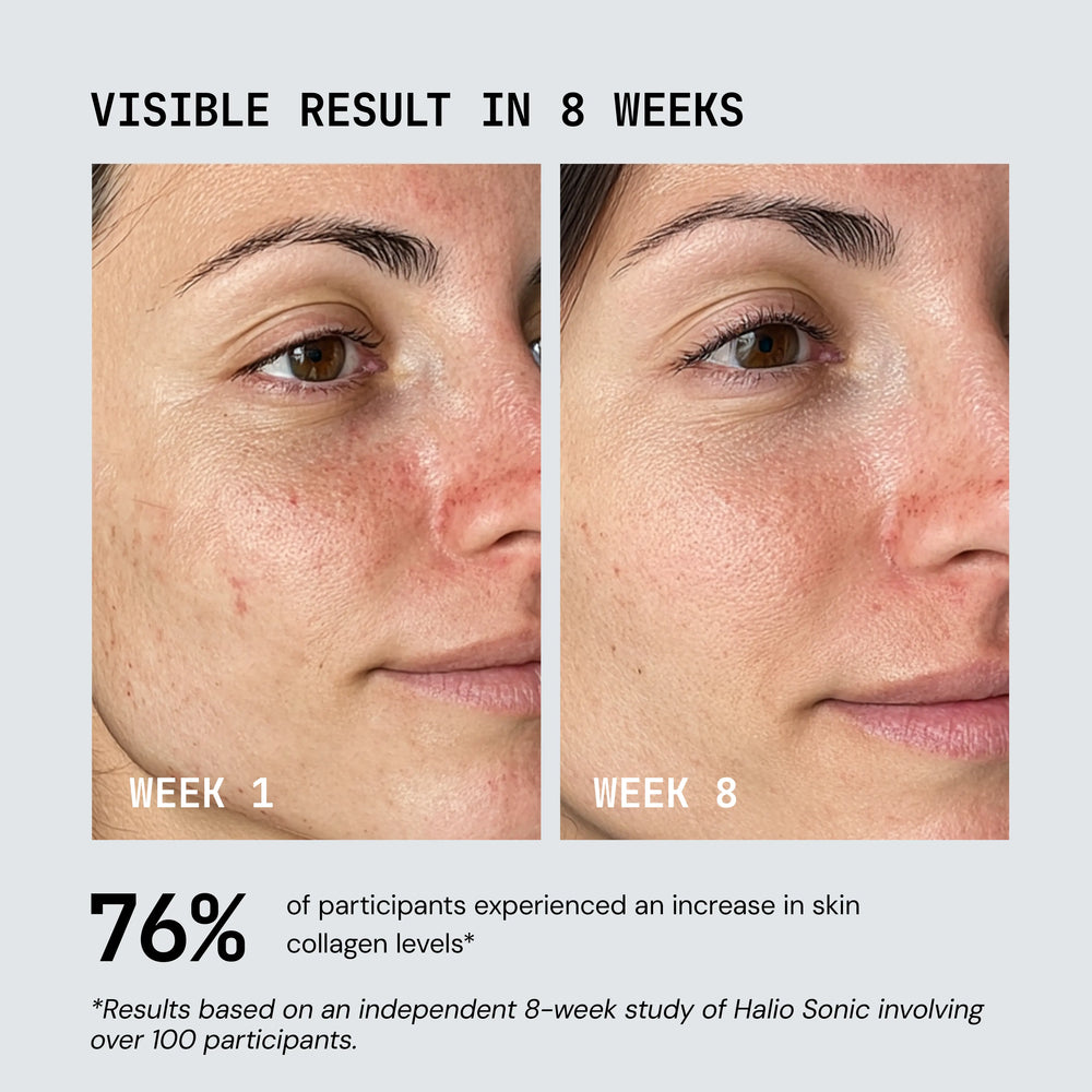 Halio RevitaWave Skin Rejuvenator photograph 5